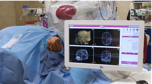Brain Lesion Detection and Robotic Path Planning